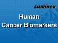 Luminex 人类肿瘤标志物 液相悬浮芯片